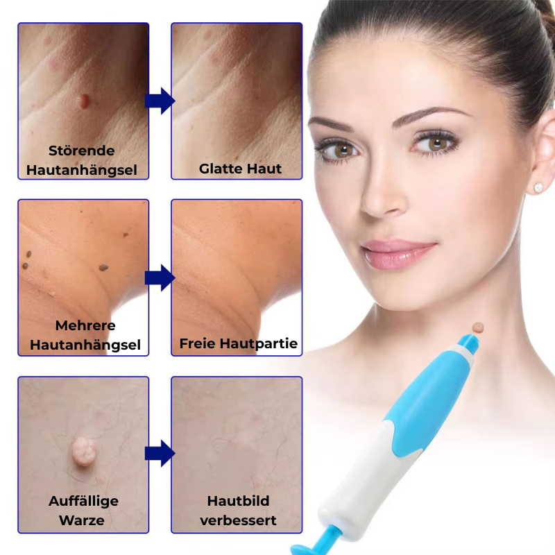 SkinNova™ – Dein neuer Weg zu reiner Haut