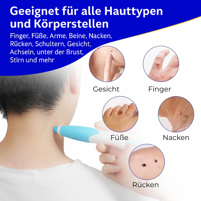 SkinNova™ – Dein neuer Weg zu reiner Haut