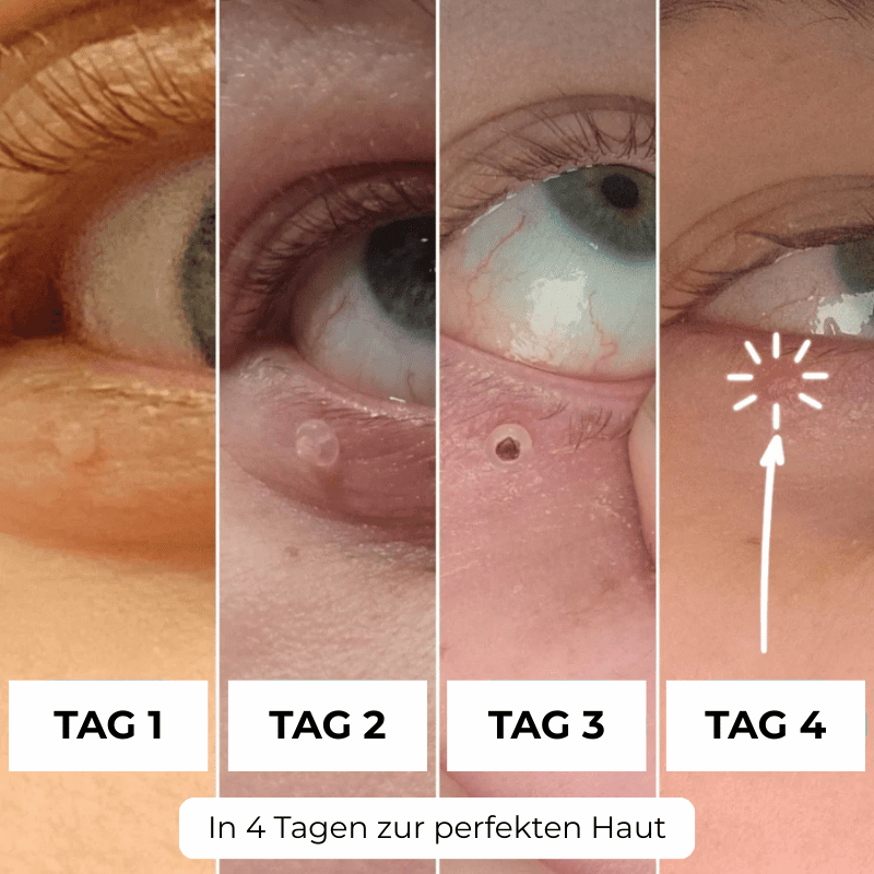 SkinNova™ – Dein neuer Weg zu reiner Haut